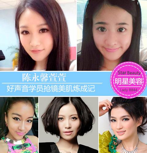 陈永馨萱萱 好声音学员抢镜美肌炼成记