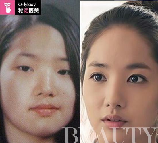“整容最厉害”的韩国女星 朴敏英终成大美女