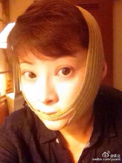 拼了!袁立为瘦脸绑绷带