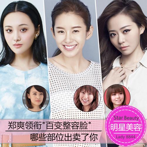 郑爽张子萱“百变整容脸” 哪些部位出卖了你