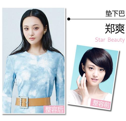 鹅蛋脸变锥子脸