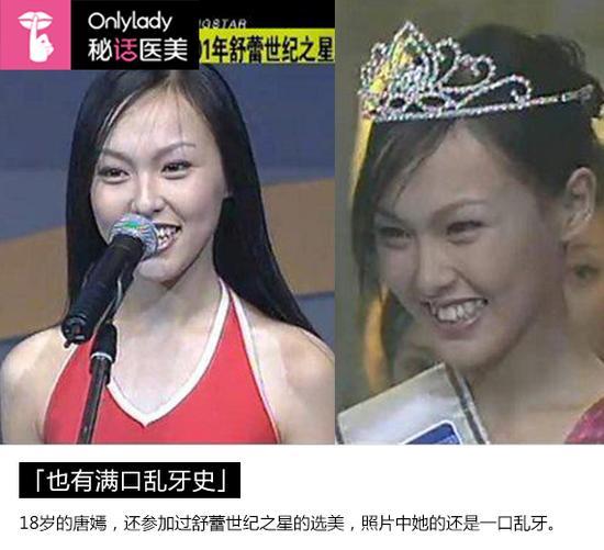满口乱牙
