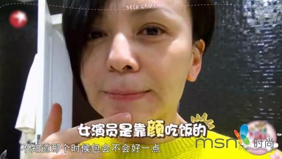 王琳