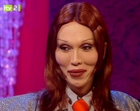Pete Burns