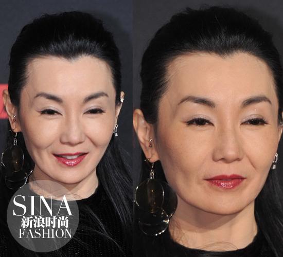 松弛下垂