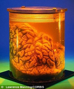 研究小组发现,脑容量大小(图中是一个泡在罐中的大脑)在解释人智商高低问题上作用不大。