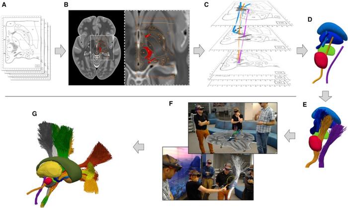Neuron重磅：第一个全息大脑“图谱”的建立，或极大促进神经解剖和脑外科！
