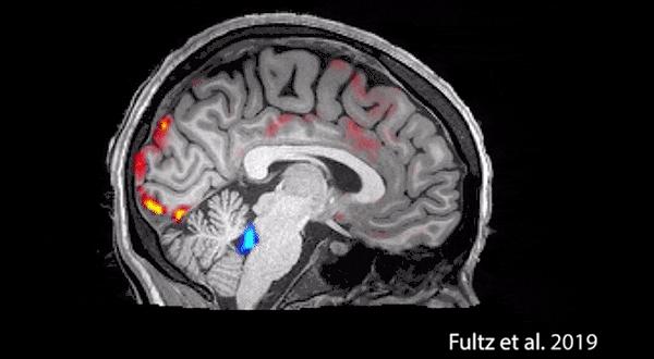 科学家首次拍到:人睡着时清洗大脑全过程!熬夜会变傻终于有科学依据了