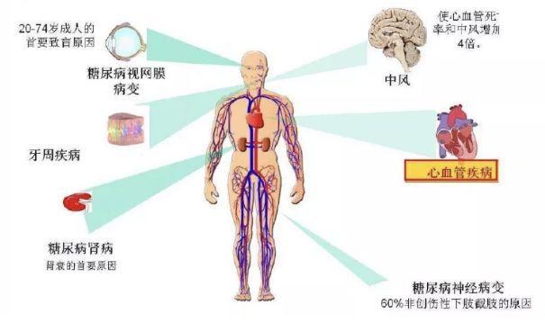 每30秒就有一个患者要截肢！这个病原来这么“凶”…