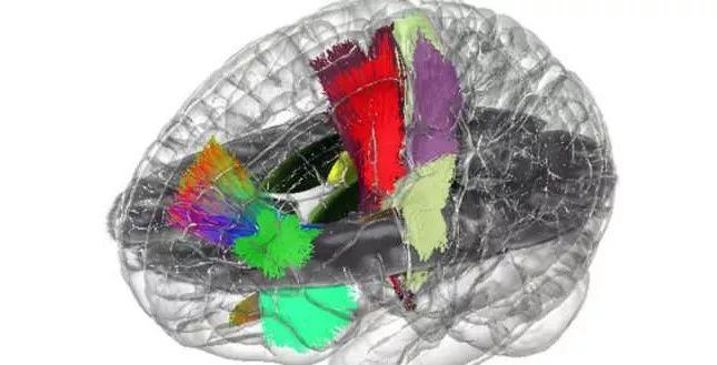 Neuron重磅：第一个全息大脑“图谱”的建立，或极大促进神经解剖和脑外科！