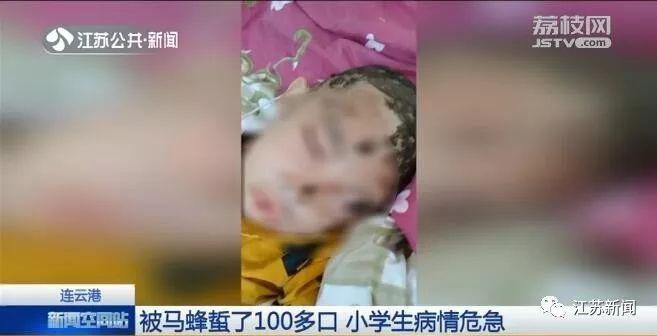 小学生放学路上被袭击至休克，直接进了ICU！出门千万小心它，现在正是活跃期