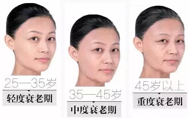 线雕