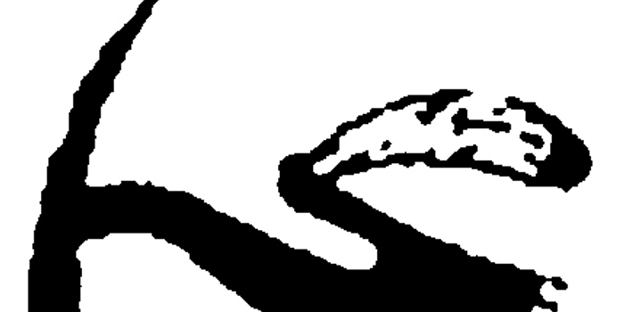 13岁女孩脑血管畸形导致颅内出血手术花光父