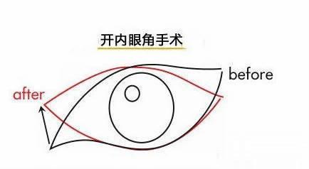 眼角