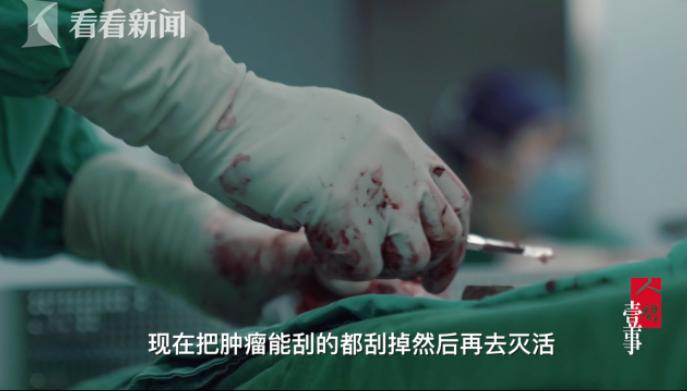 子涵的手术需要截断腿骨、刮除肿瘤、去除活性