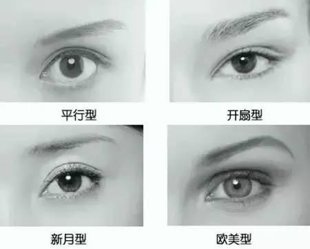 双眼皮形状