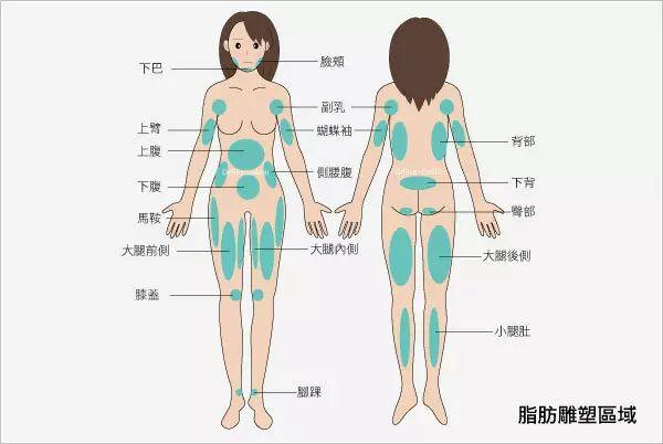 吸脂术