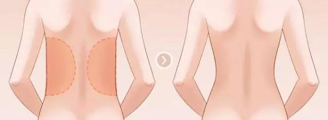 塑形