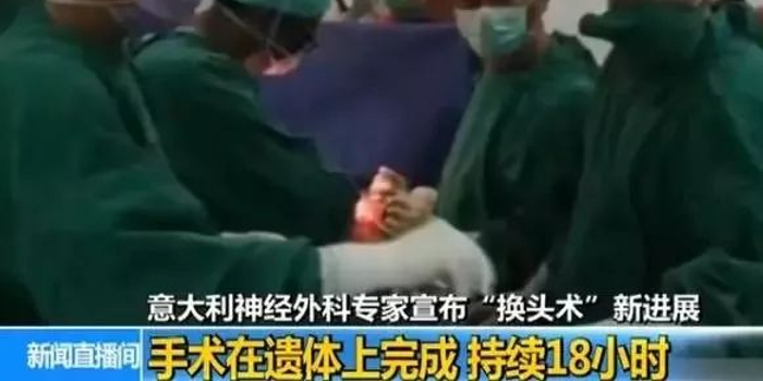 换头手术真的存在吗 w700h350z1l10t10bf3.jpg