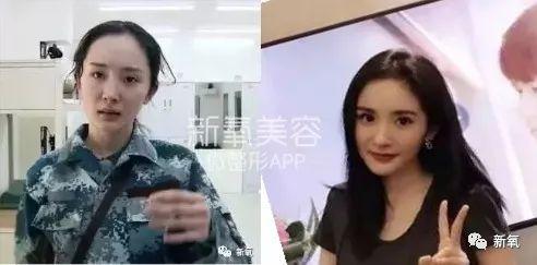 杨幂发际线的变化