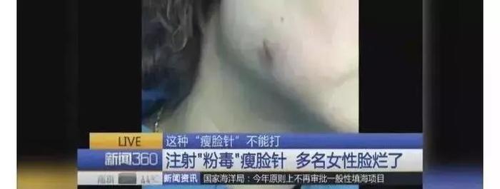 新闻