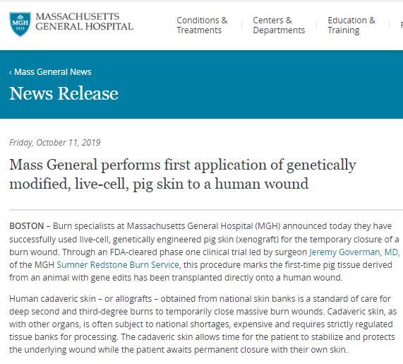 经基因工程改造的活细胞猪皮成功被用于治疗人类烧伤伤口