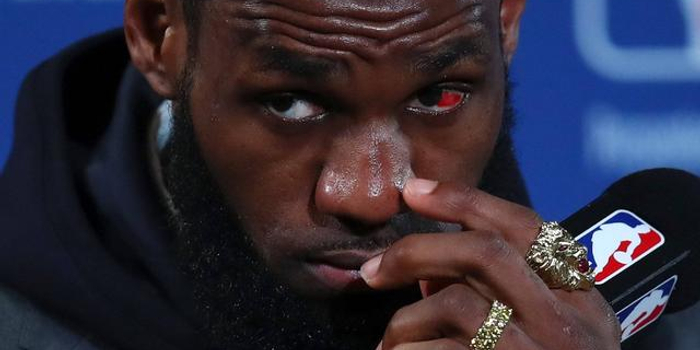 詹姆斯伤势图 w700h350z1l10t10f65.jpg