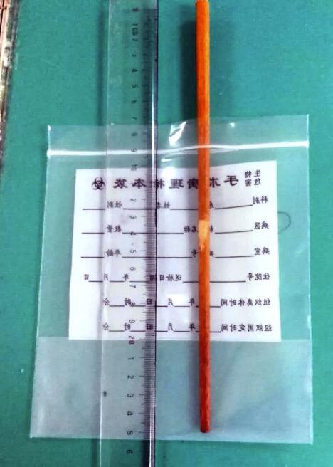 3岁女童手持筷子玩耍跌倒 筷子从口入颅内10厘米