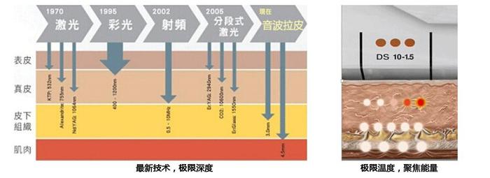 超声刀就是烤肉也没关系，因为它对脸垮是真的有效！