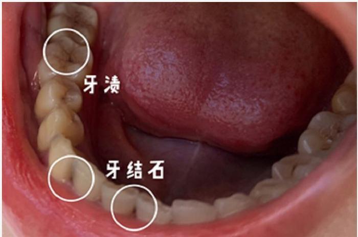 吴谨言是被他整毁的脸下蛊了吗？