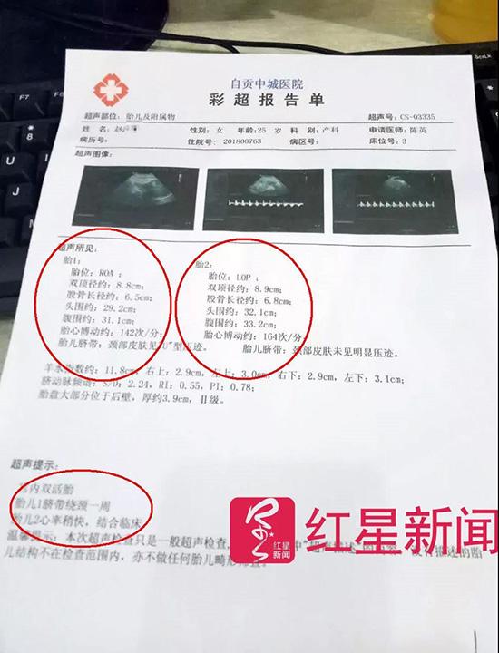 8月22日,赵洋洋在自贡中城医院的术前彩超报告单 受访者供图