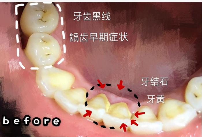 吴谨言是被他整毁的脸下蛊了吗？