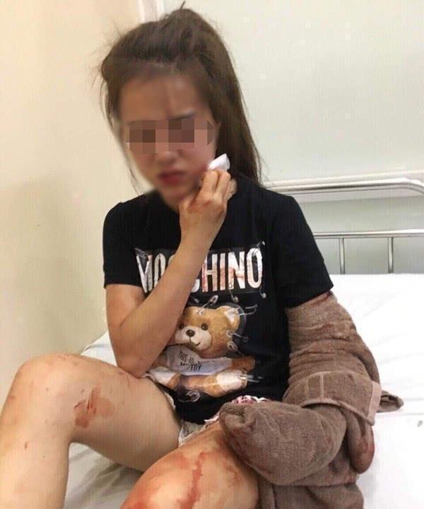 惨！18岁女子被闺蜜持刀割伤脸部，缝60针毁容破相