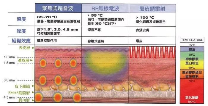 超声刀就是烤肉也没关系，因为它对脸垮是真的有效！