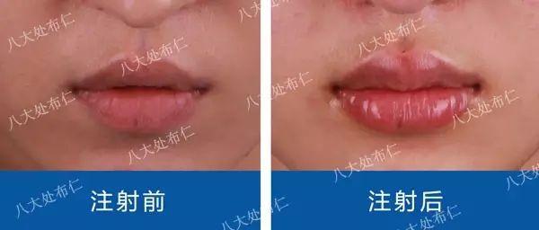 对比