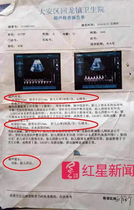 赵洋洋在自贡大安区回龙镇卫生院的超声检查报告单 受访者供图