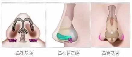 鼻基底在哪里