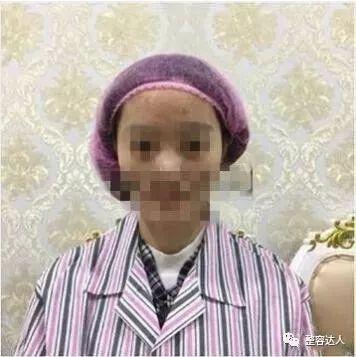 术前
