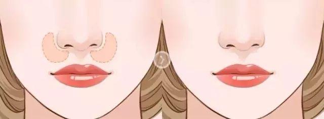 鼻基底