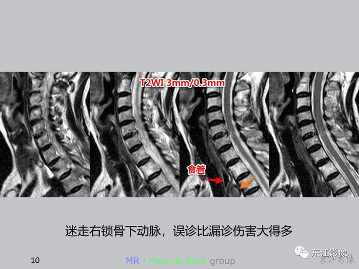 【病例分享】这些案例告诉影像科医生，这样做能大大减少漏诊误诊率