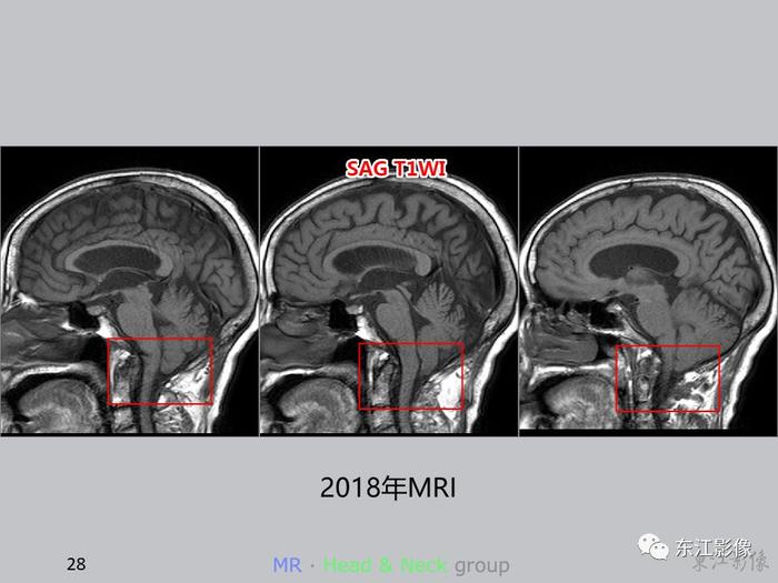 【病例分享】这些案例告诉影像科医生，这样做能大大减少漏诊误诊率