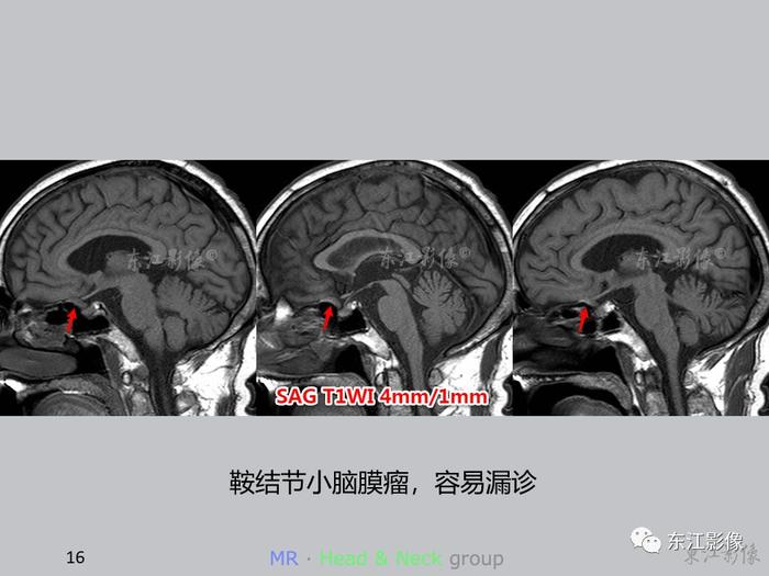 【病例分享】这些案例告诉影像科医生，这样做能大大减少漏诊误诊率