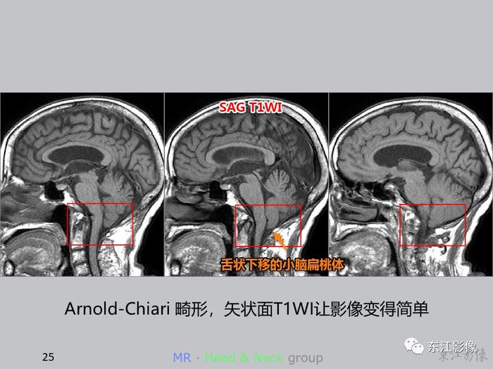 【病例分享】这些案例告诉影像科医生，这样做能大大减少漏诊误诊率