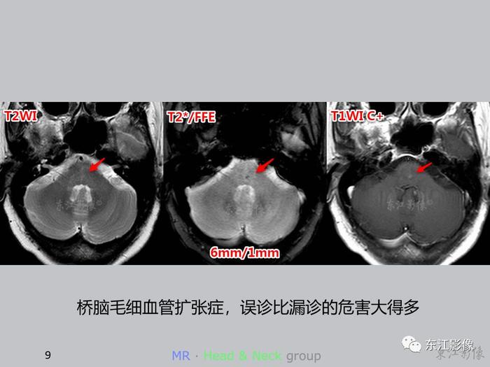 【病例分享】这些案例告诉影像科医生，这样做能大大减少漏诊误诊率