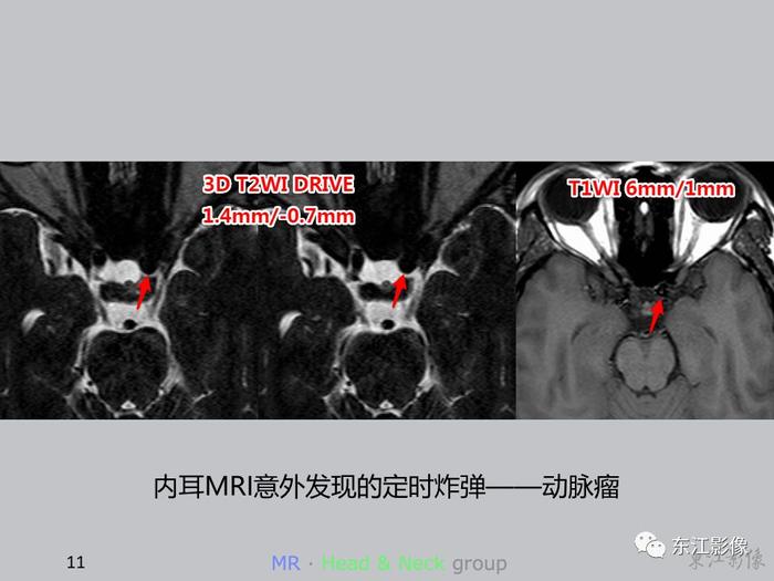 【病例分享】这些案例告诉影像科医生，这样做能大大减少漏诊误诊率