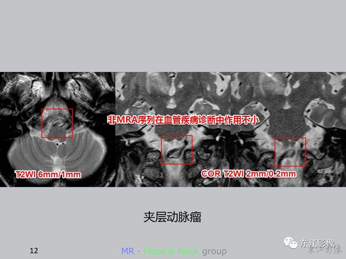 【病例分享】这些案例告诉影像科医生，这样做能大大减少漏诊误诊率