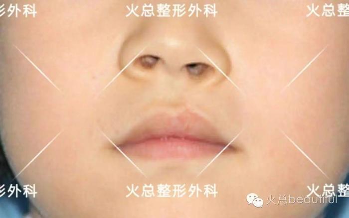 患者
