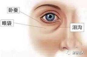 眼睛