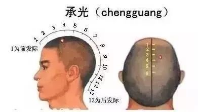 承光穴的准确位置图