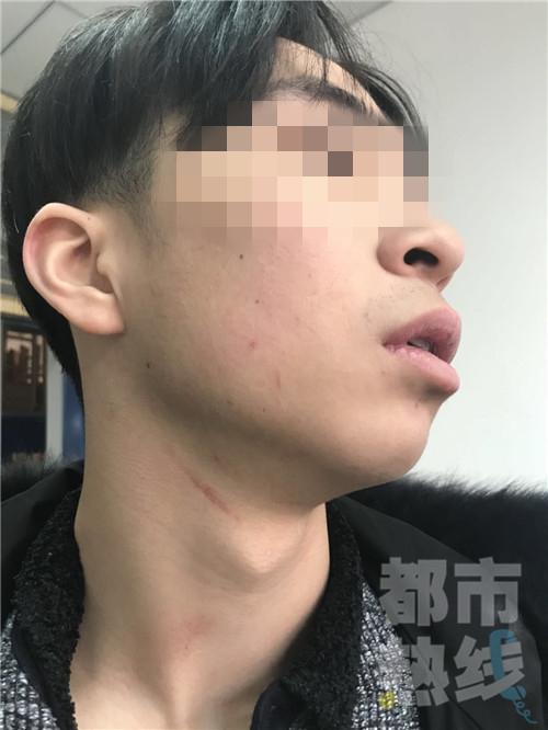 扇脸、用棍子抽打、踢裆部！西安一学生因迟到被老师打致睾丸受伤！